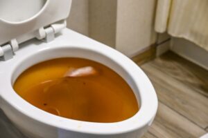 clogged toilet with water and sewage backed up